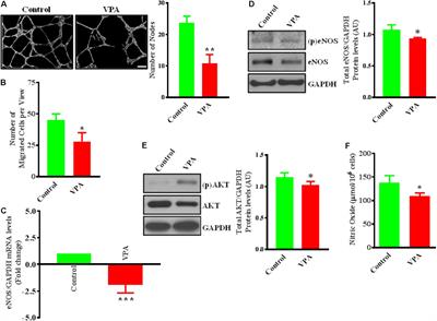 Valproic Acid Induces Endothelial-to-Mesenchymal Transition-Like Phenotypic Switching